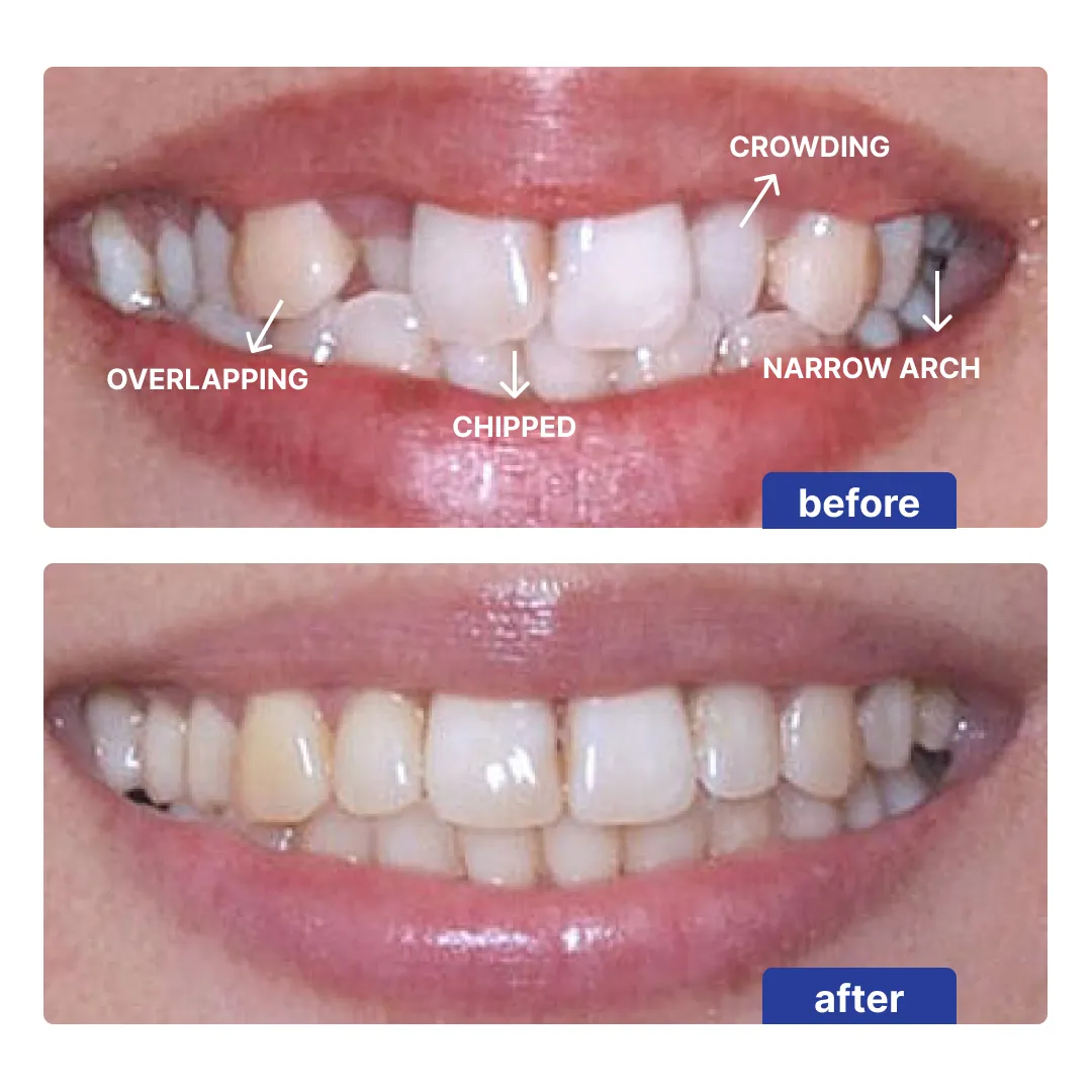 Patient result 2